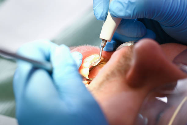 Best Broken Tooth Emergency  in Breckenridge, TX