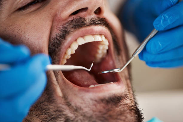 Best Root Canal Emergency Dentist  in Breckenridge, TX